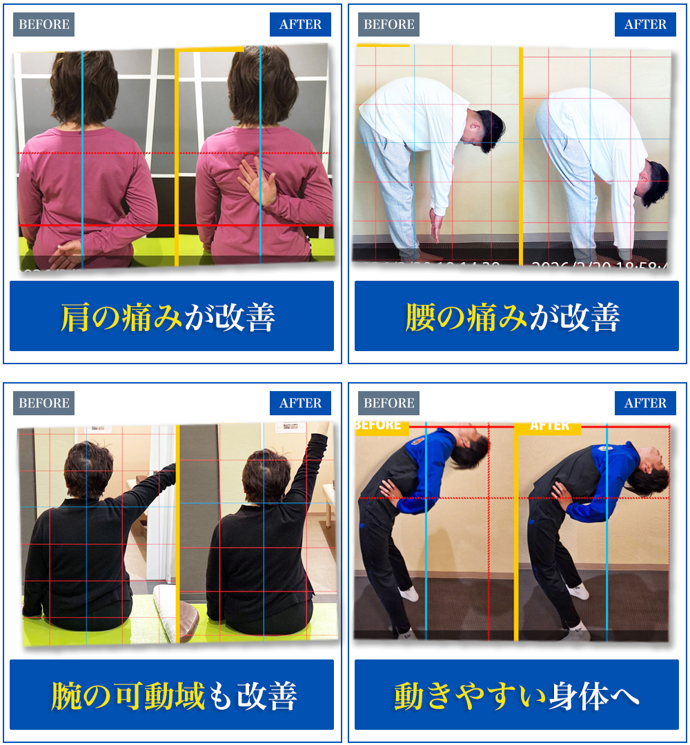 光の森院 施術によるBefore/After比較(肩の痛み・腰の痛み・腕の可動域・動きやすさの変化)