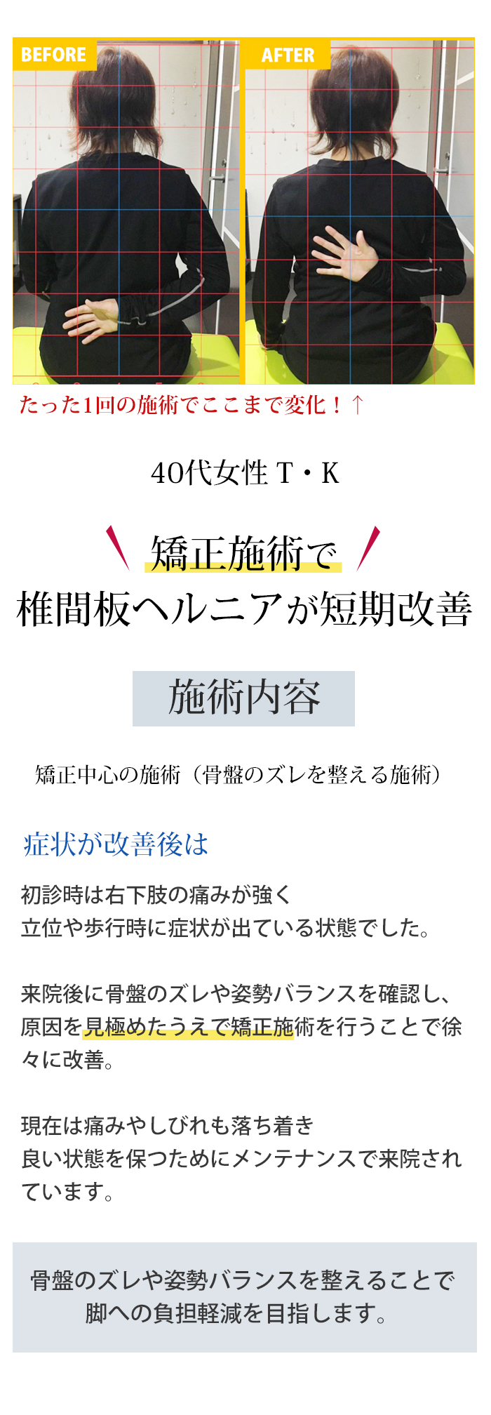 Before After 椎間板ヘルニアでお悩みだった方の変化