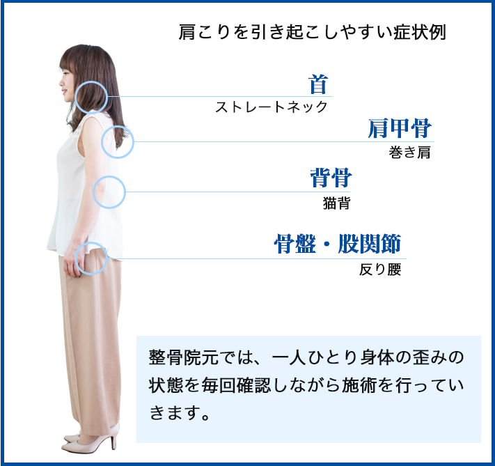 肩こりにつながりやすい身体の状態