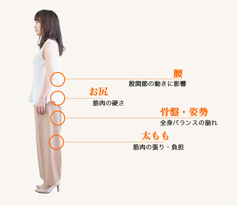 股関節の痛みに関係しやすい部位（腰・お尻・骨盤姿勢・太もも）のイラスト