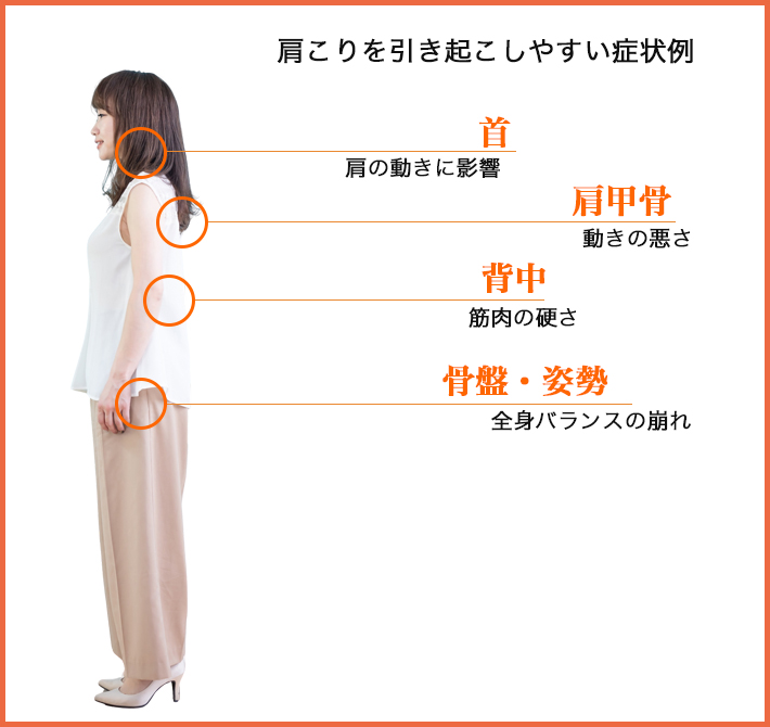 肩こりを引き起こしやすい部位（首・肩甲骨・背中・骨盤姿勢）のイラスト