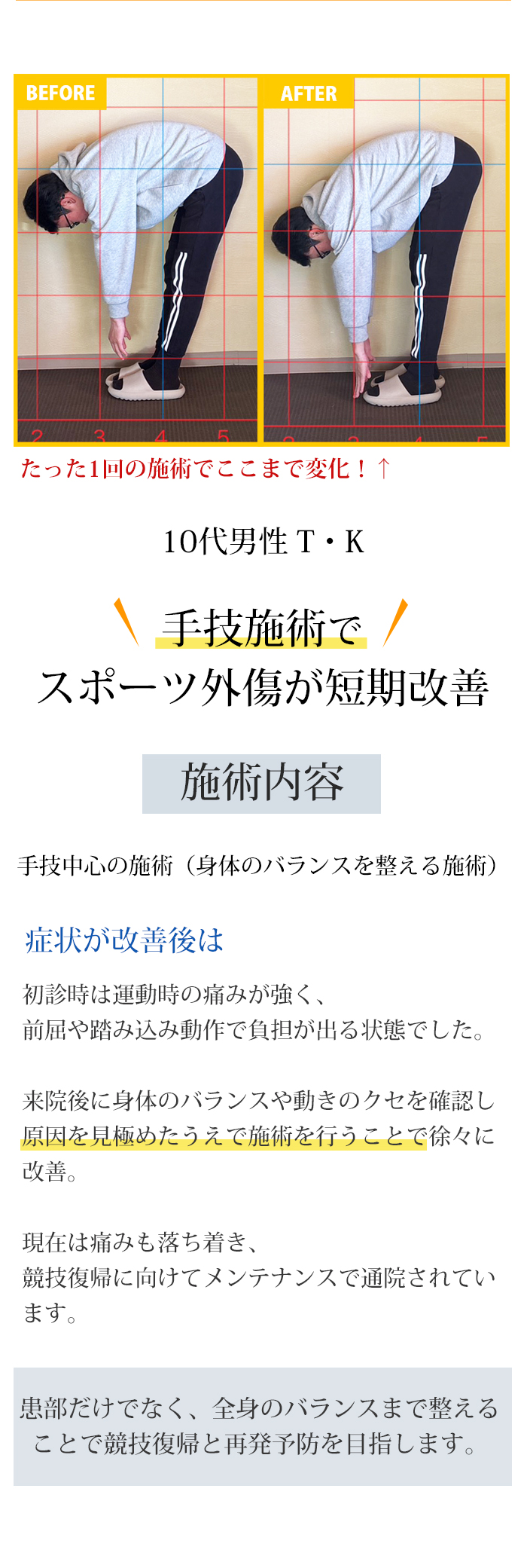 Before After 手技施術でスポーツ外傷が短期改善した10代男性の変化