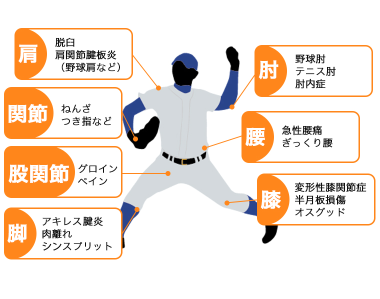 部位別スポーツ外傷イラスト（肩・肘・関節・腰・股関節・脚・膝）