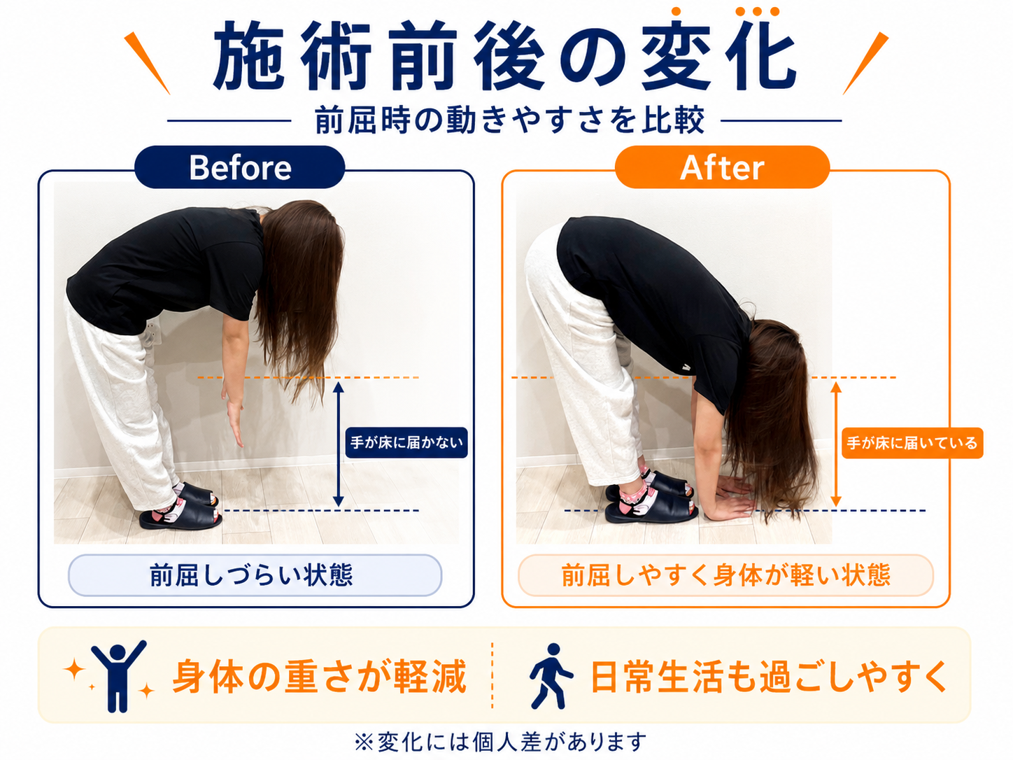 腰痛施術のビフォーアフター比較
