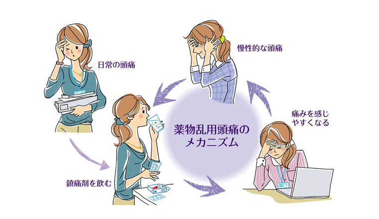 頭痛薬との付き合い方